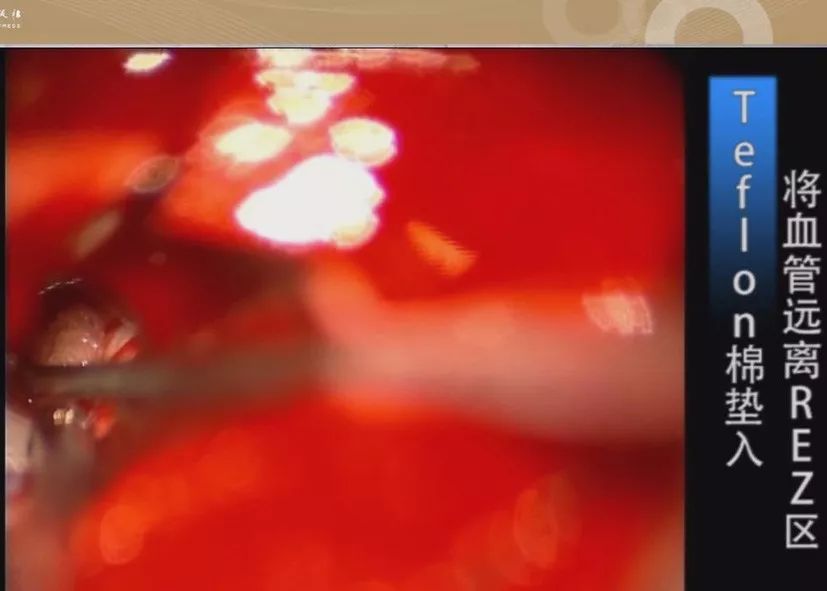 国产色婷婷在线精品一区海报